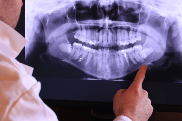 Best Emergency Dental Care for Broken or Chipped Teeth in Spanish Springs, NV