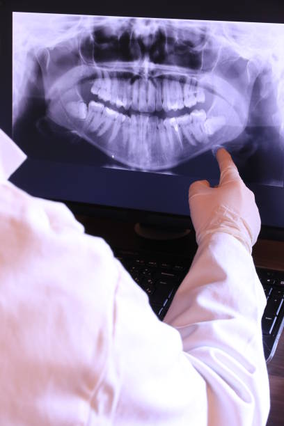 Best Emergency Gum Treatment in Spanish Springs, NV