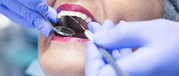 Best Emergency Wisdom Teeth Removal in Spanish Springs, NV
