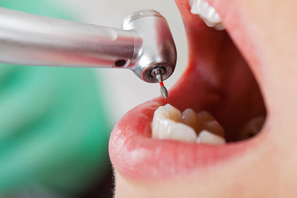 Best Emergency Treatment for Dental Infections or Abscesses in Spanish Springs, NV